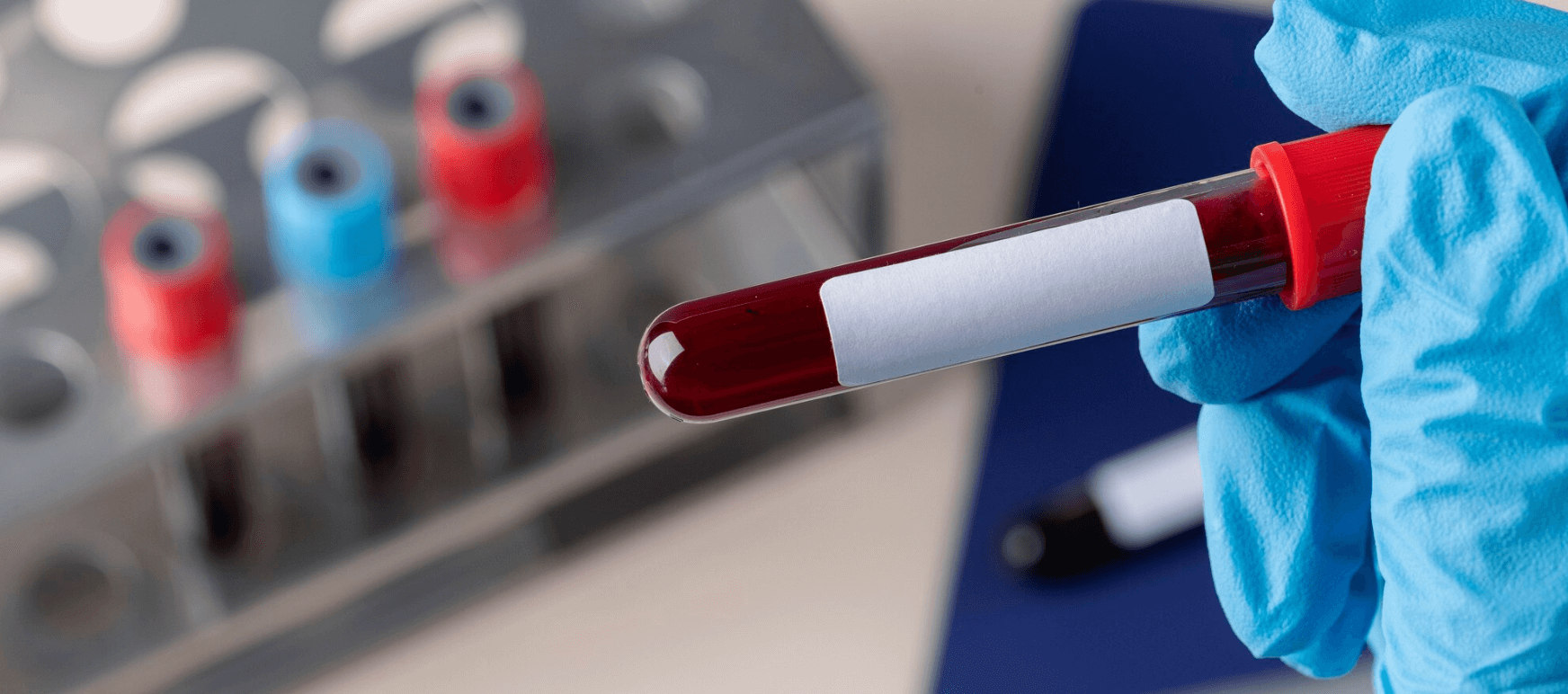 blood sample
